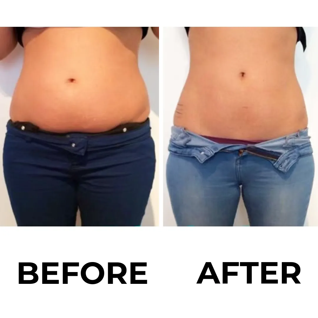 Before and after results example for [Your Flagship Treatment]