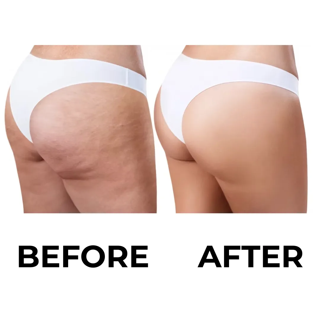 Before and after results example for [Your Flagship Treatment]
