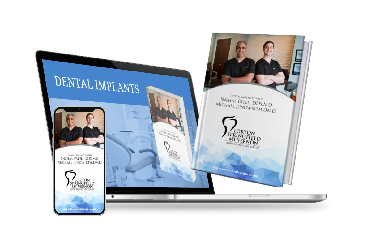 Dental Implant Free Guide Lorton Oral Surgery
