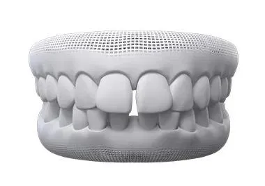 Espacio entre los dientes