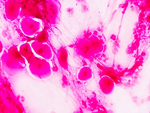 How Bartonella Affects the Nervous System & Energy