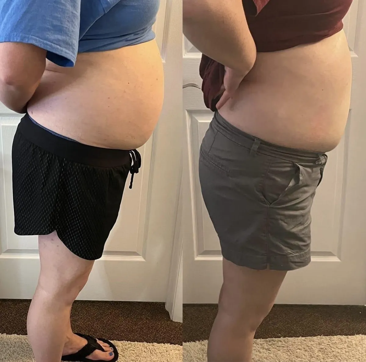 red light therapy before and after 