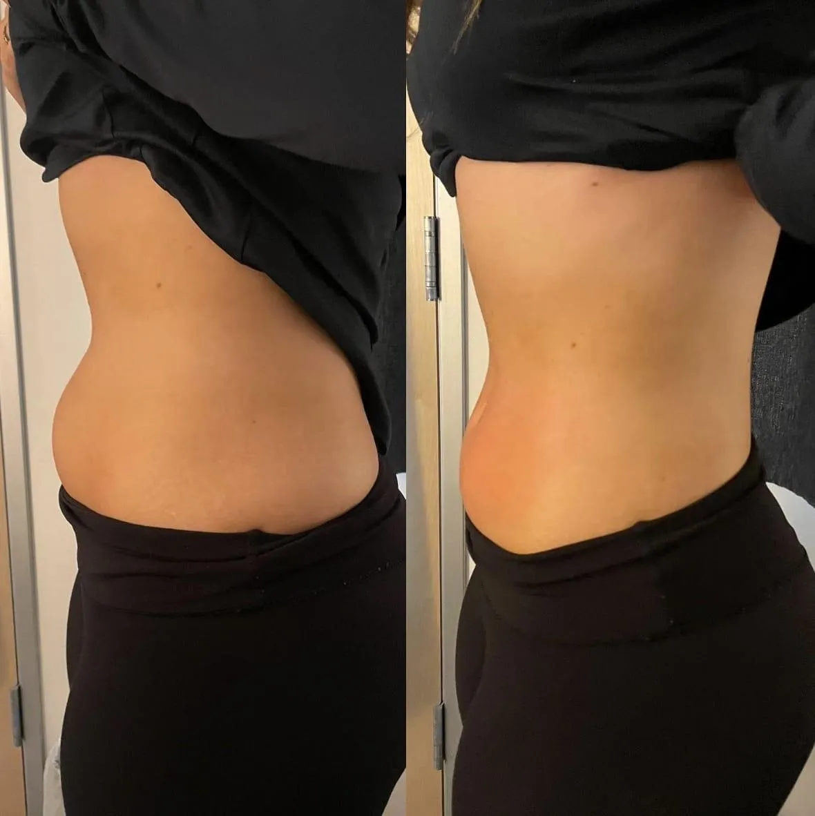 red light therapy before and after woman