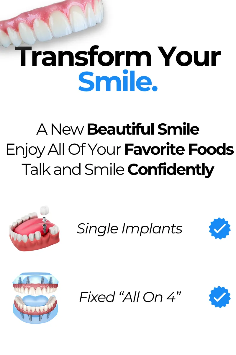 Smile With Confidence - Dental Implants