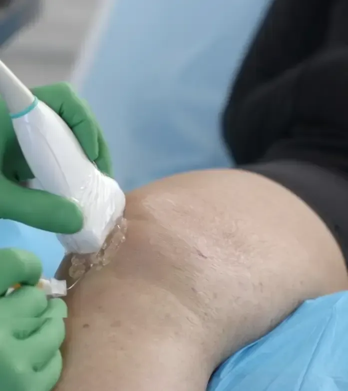 PRP Masters Knee The Fascinating Facts About Knee Regenerative Medicine