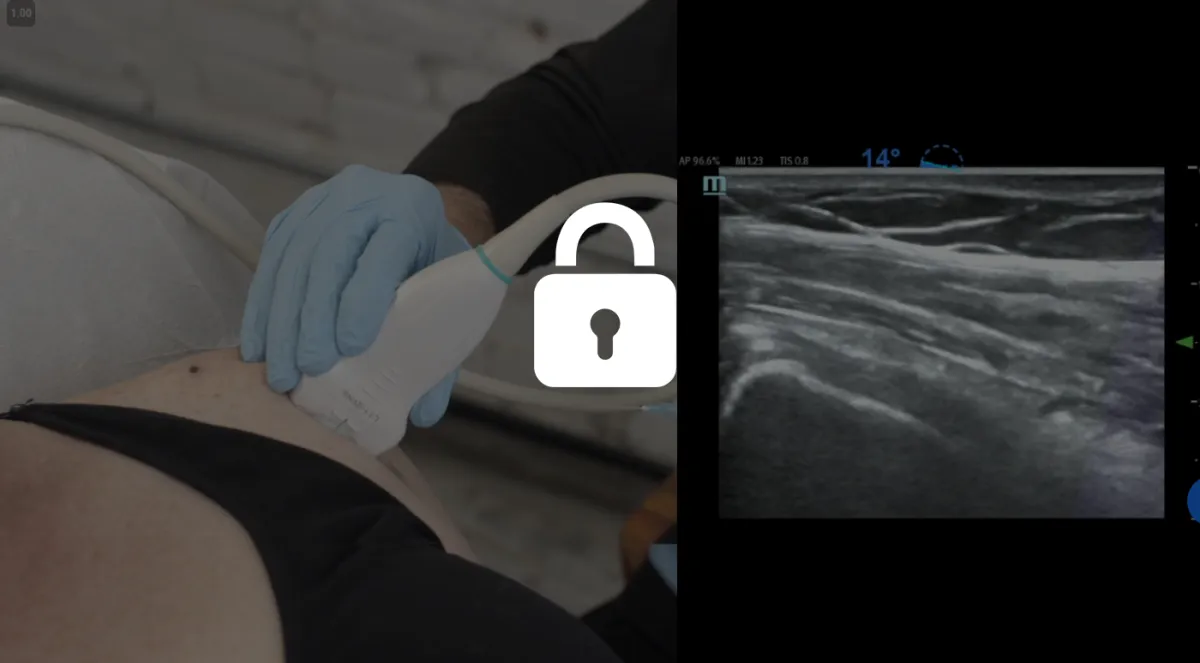 PRP Masters Shoulder Pre-Injection Anesthesia