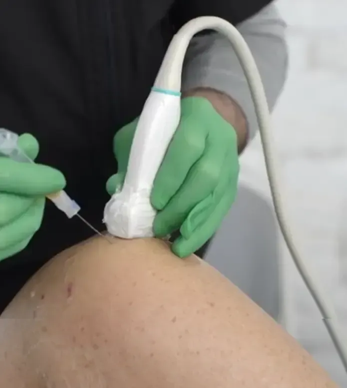 PRP Masters Your Gateway to Knee Regeneration