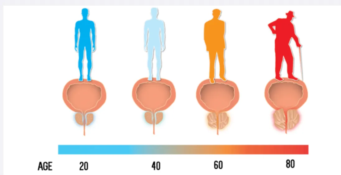 prostate-stage