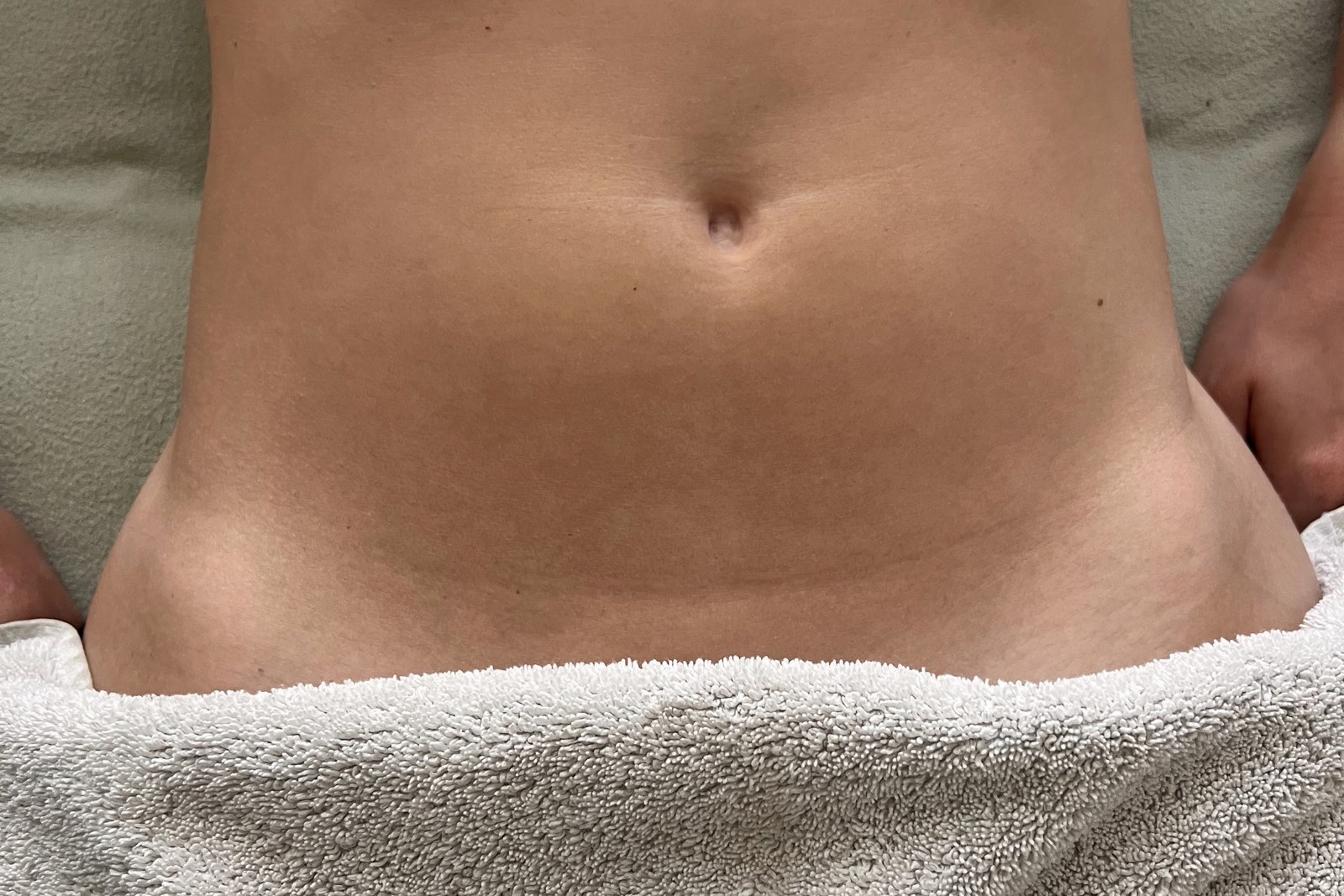 Lymphatic Drainage After a Tummy Tuck: What the Protocol Looks Like