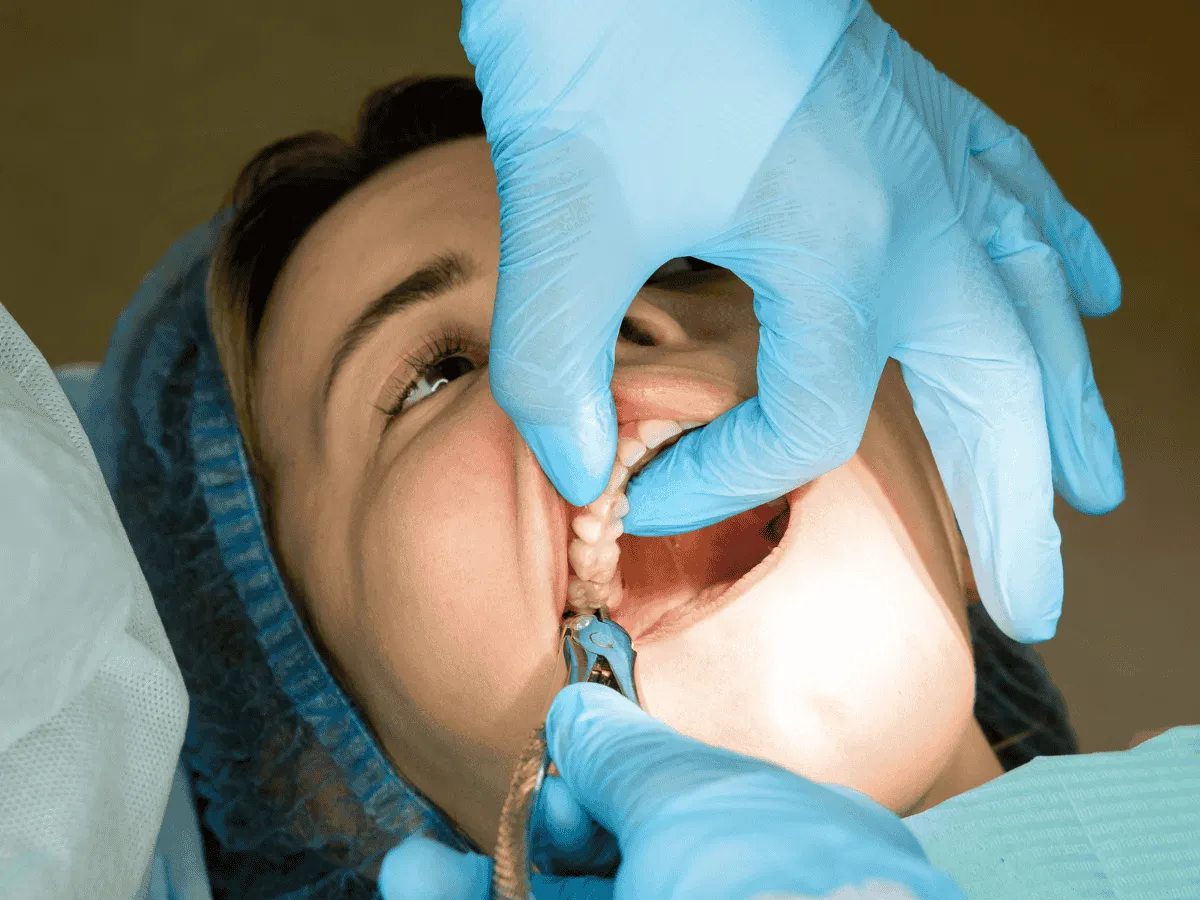 Gentle Extraction