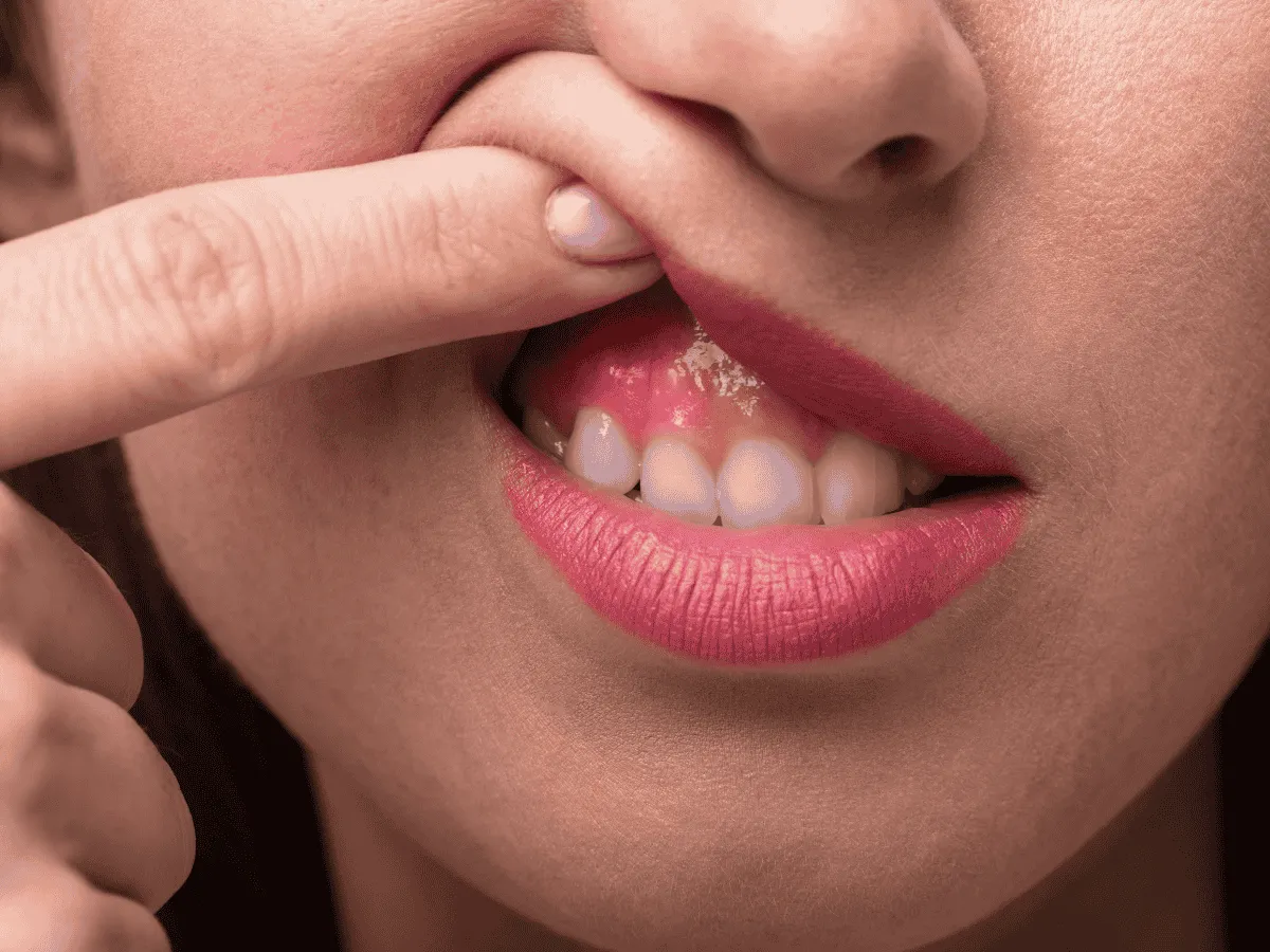 Invisalign® Clear Aligners