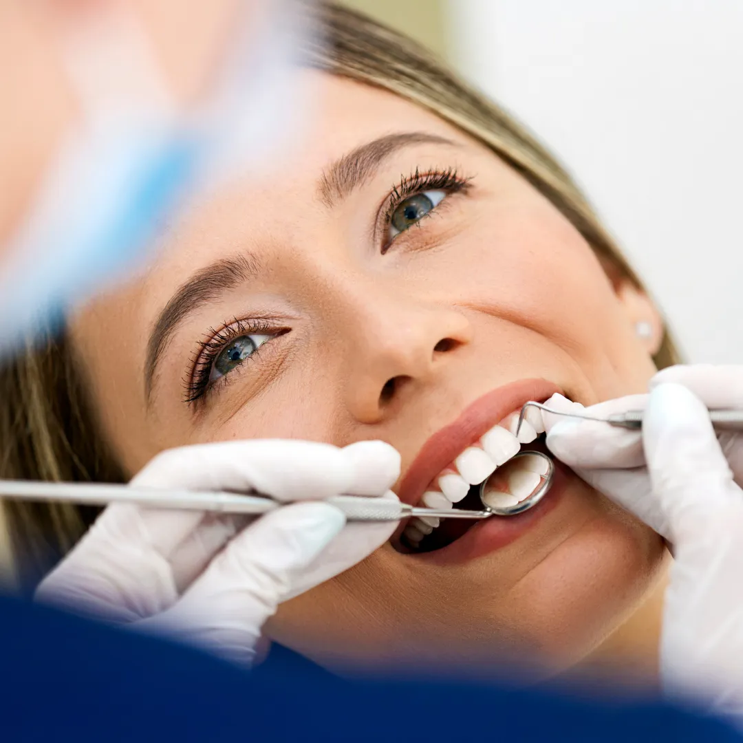 Close-up of dental polishing tool shining a patient’s teeth