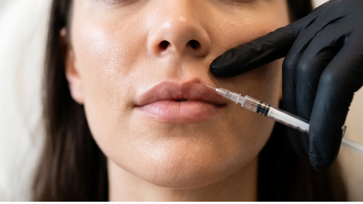 Lip Filler Near Clinton Township, MI | Treuvis Med Spa