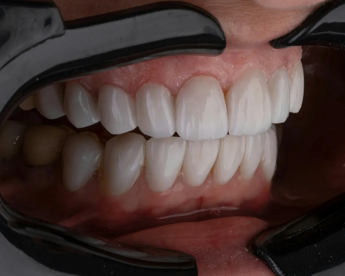 a close up of a person's teeth