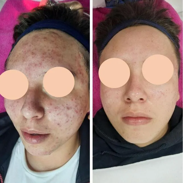 Caso 6