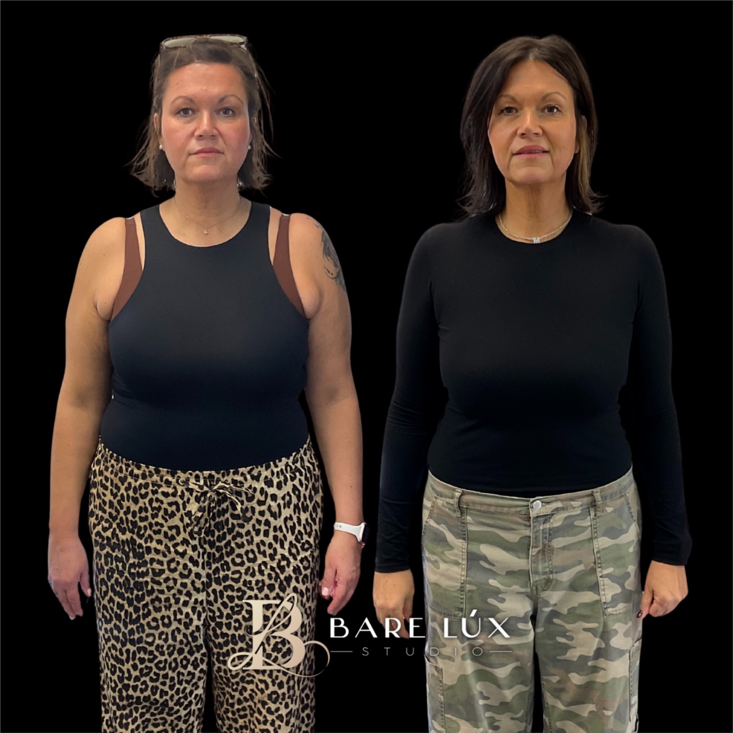 BareLux Studio Before And After 2