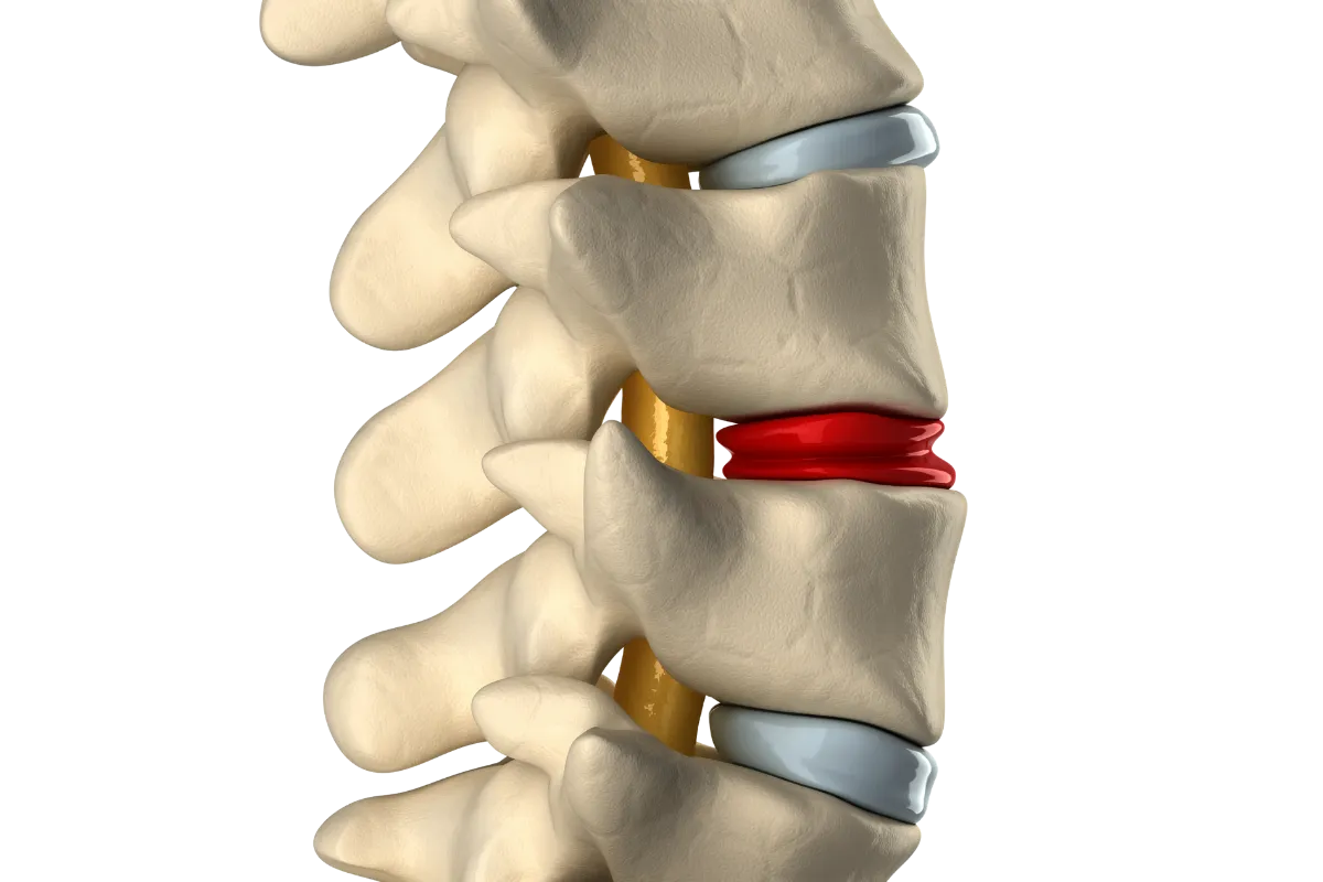 A black and white photo of a woman's back