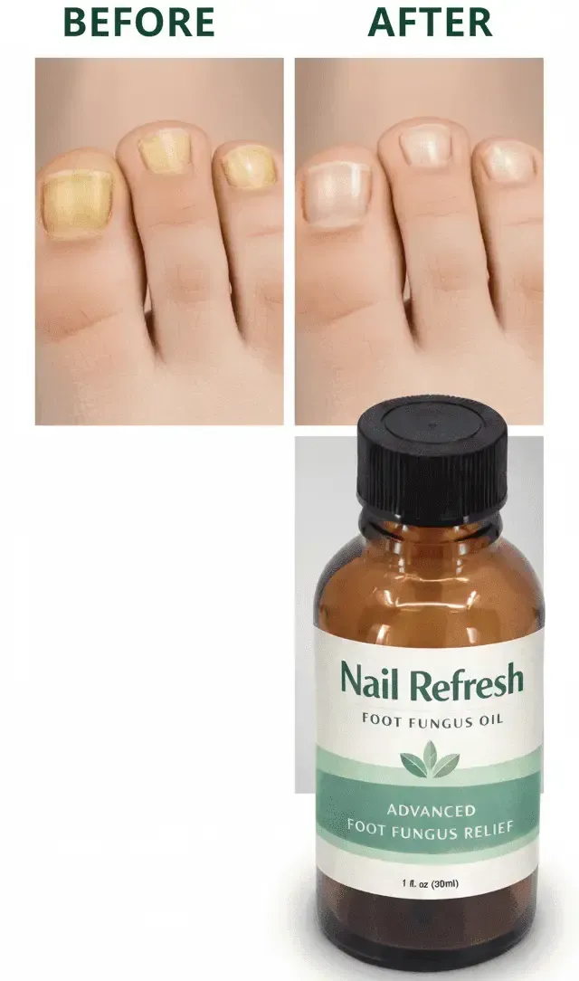 Nail Refresh 