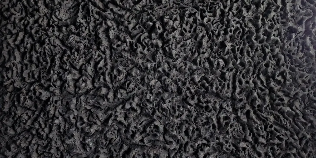 temporomandibular joint dysfunction