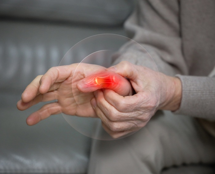 arthritis pain in hands