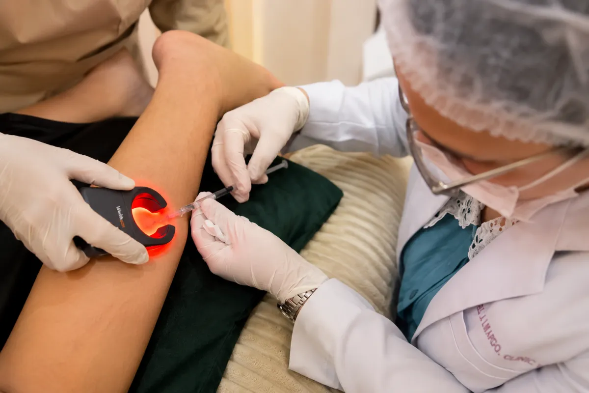 Smooth Legs and Spider Vein Removal in Manila: Your Expert Guide to Zero Downtime Sclerotherapy at MOLD Manila