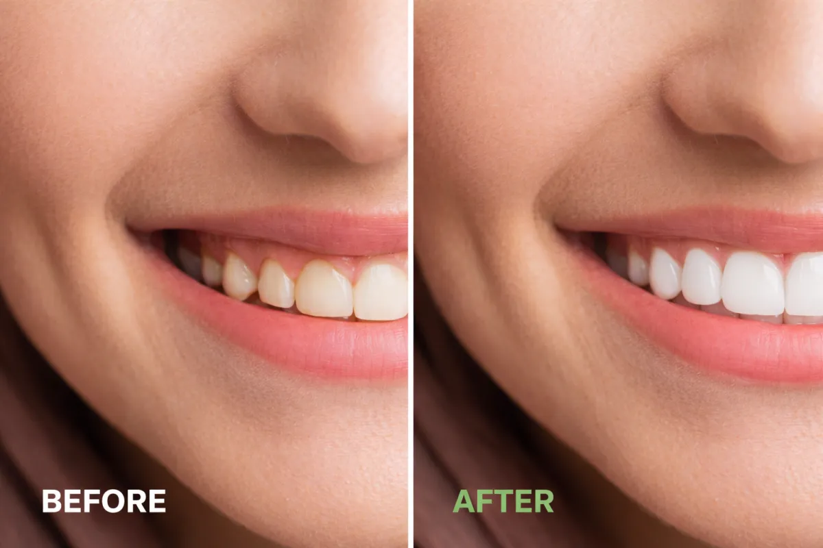 Cosmetic dentist showing a patient their Digital Smile Design preview during an AI-informed consultation