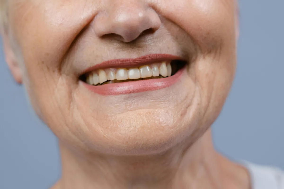 Older woman showing teeth