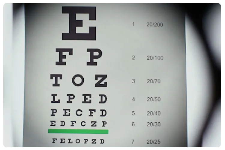 Explore Kleinwood Vision’s Comprehensive Eye Exam Solutions
