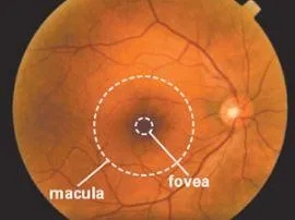 Macular Degeneration