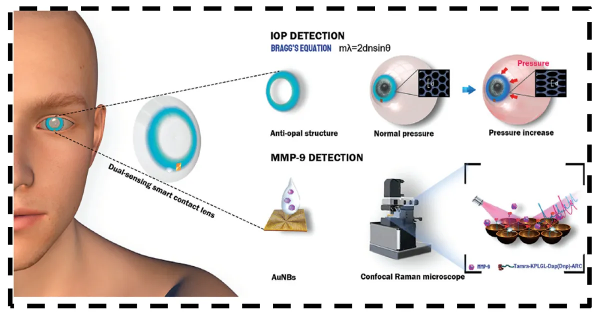 detecting glaucoma early