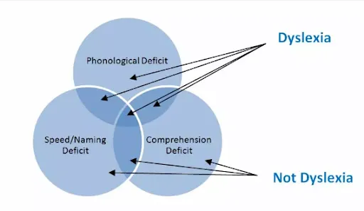 visual processing