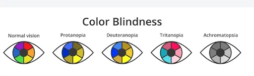 color vision deficiency