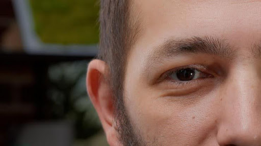 wide-field retinal imaging