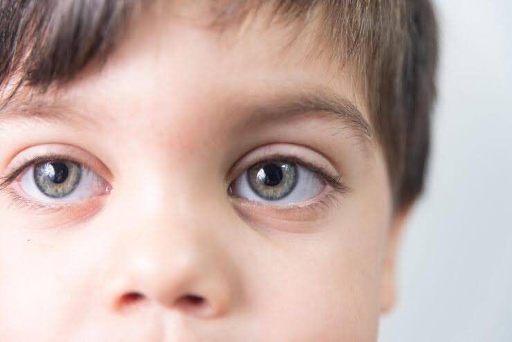 kids squint at distance