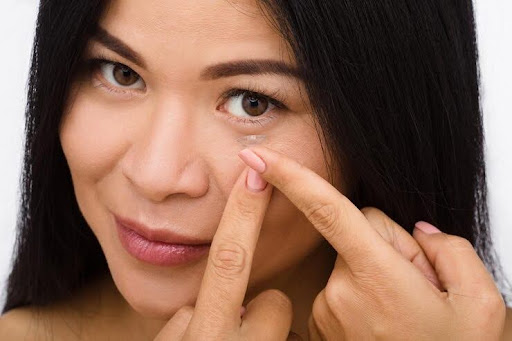 are custom contact lenses worth it
