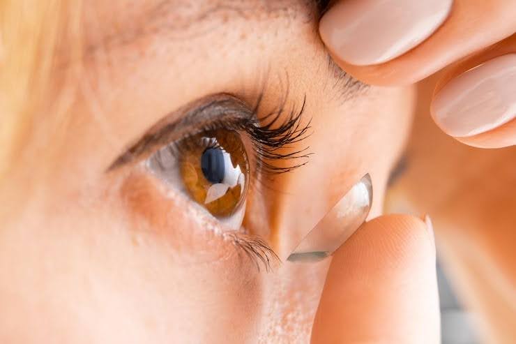 why contact lens prescriptions expire