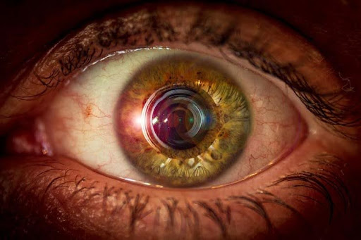 scleral lenses for irregular corneas,