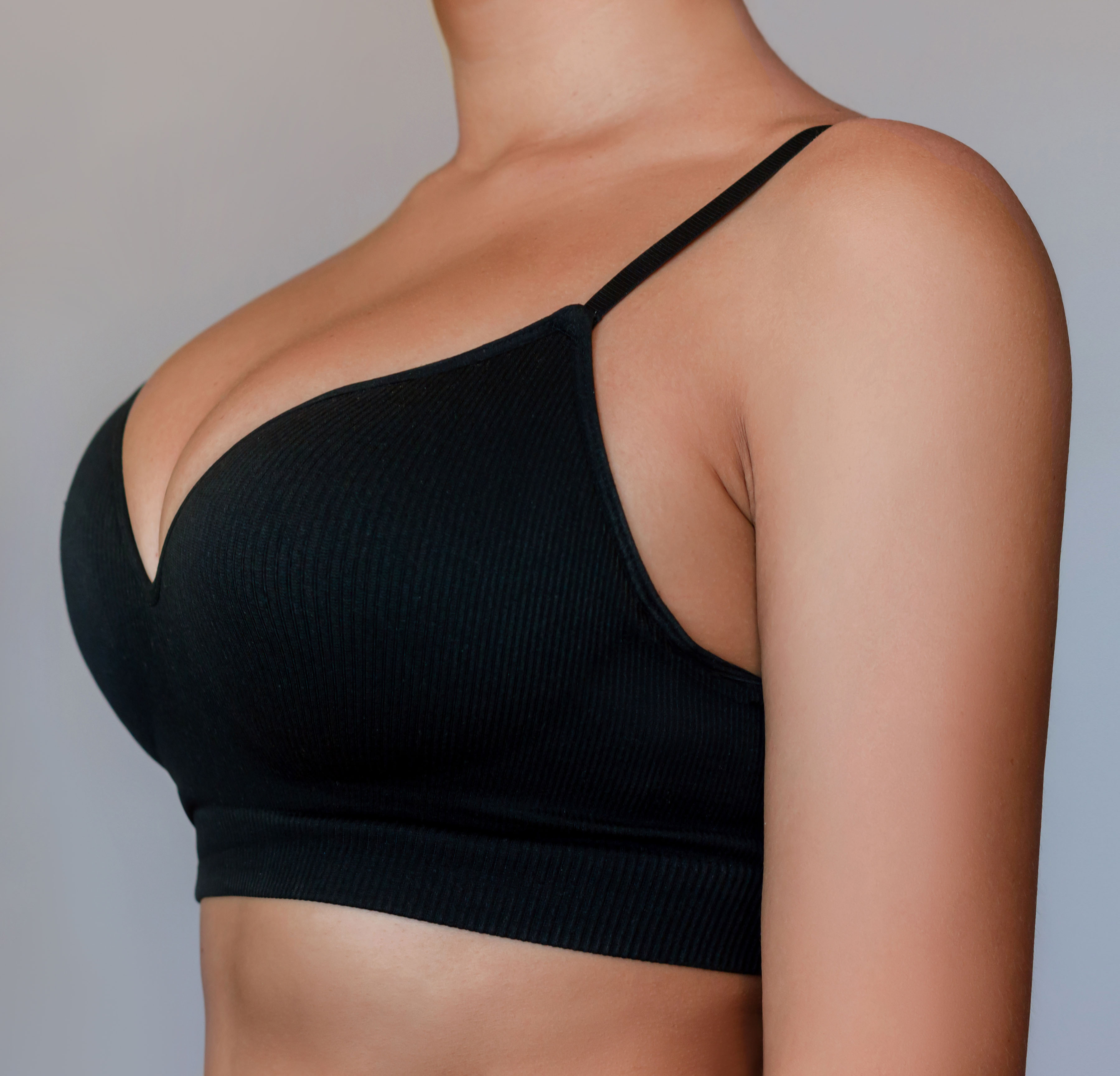 After breast augmentation example