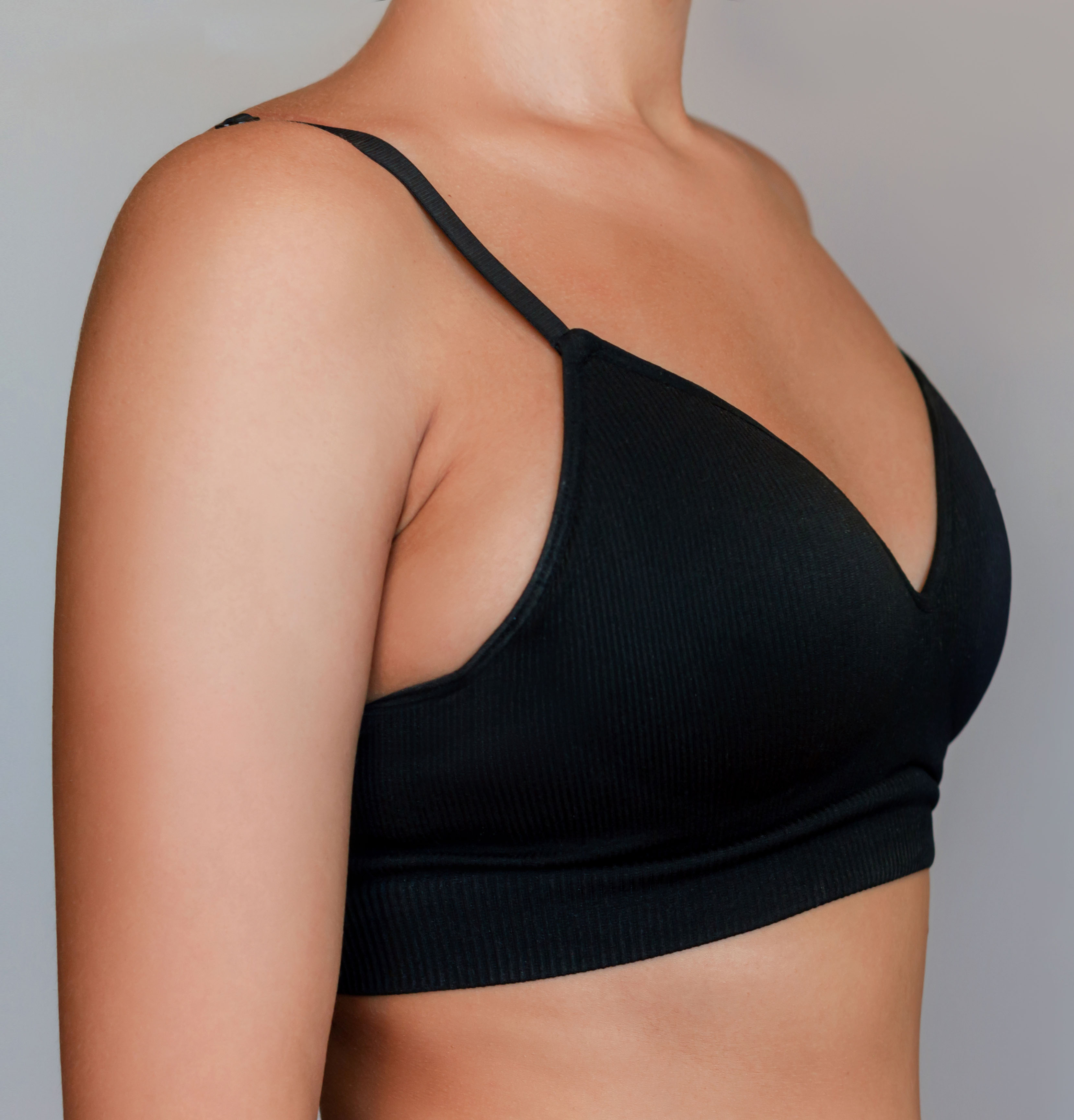 Before breast augmentation example