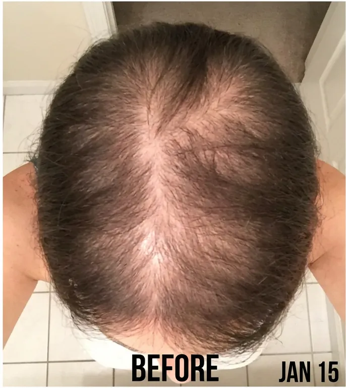 Before photo showing visible thinning at the crown.