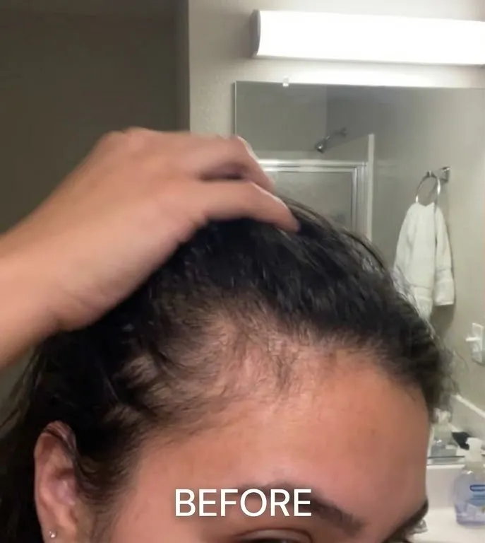 Before photo showing thinning along the part.