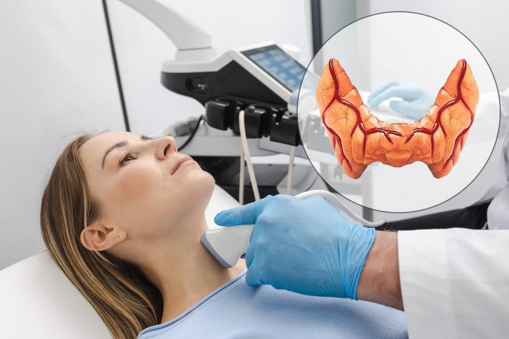 Thyroid Fatigue Solutions with Holistic Medicine Doctor