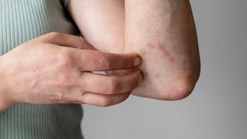 Autoimmune 101: Signs, Symptoms & Care With Advanced Integrative Medicine