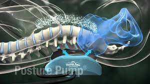 Disc Decompression Therapy in Gilbert, AZ | Optimal Spine & Health Center