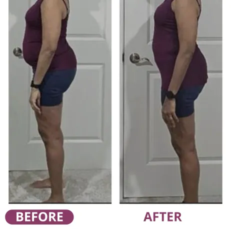 Before and after: a visibly flatter belly