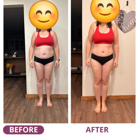 Client before and after with a toned tummy