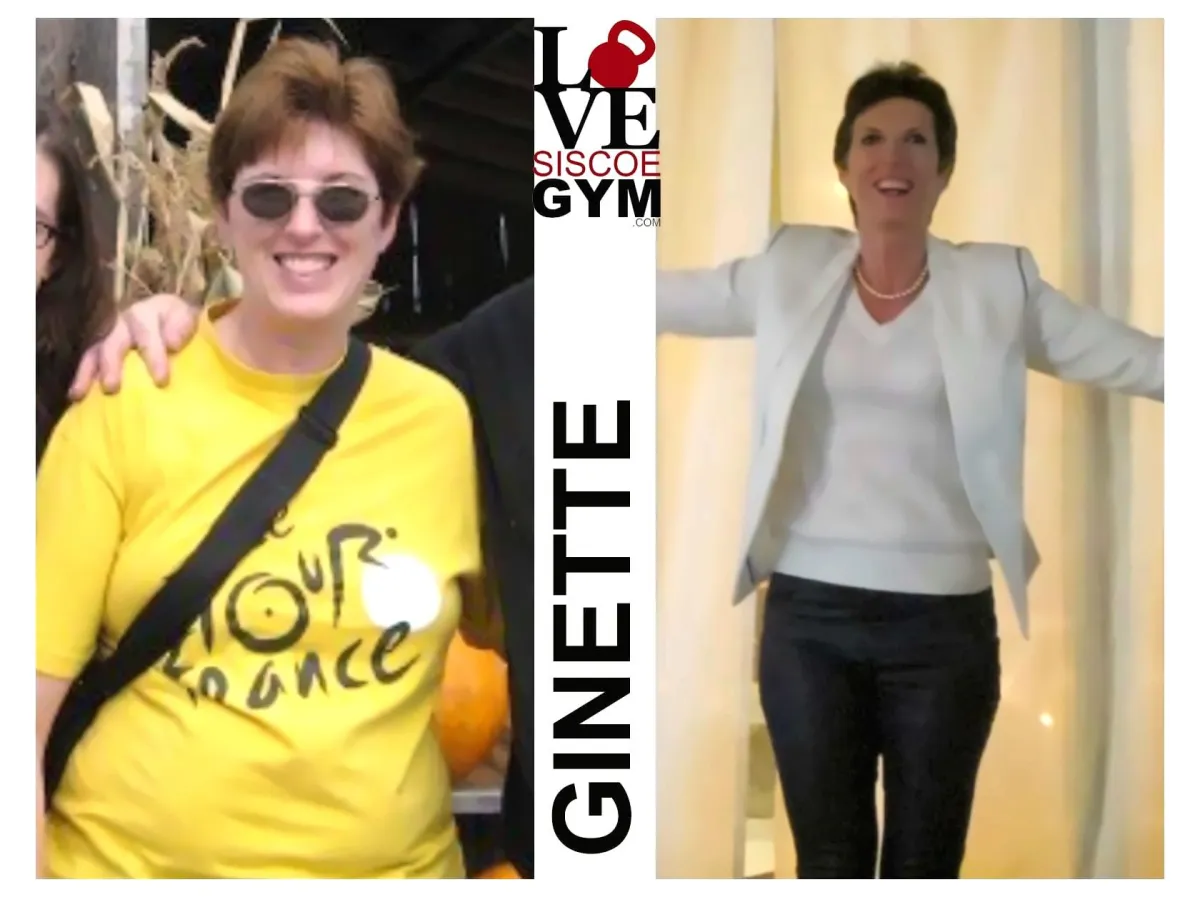 Placeholder before and after photo area