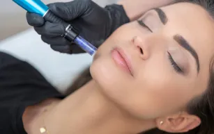 micro neelding cooper city