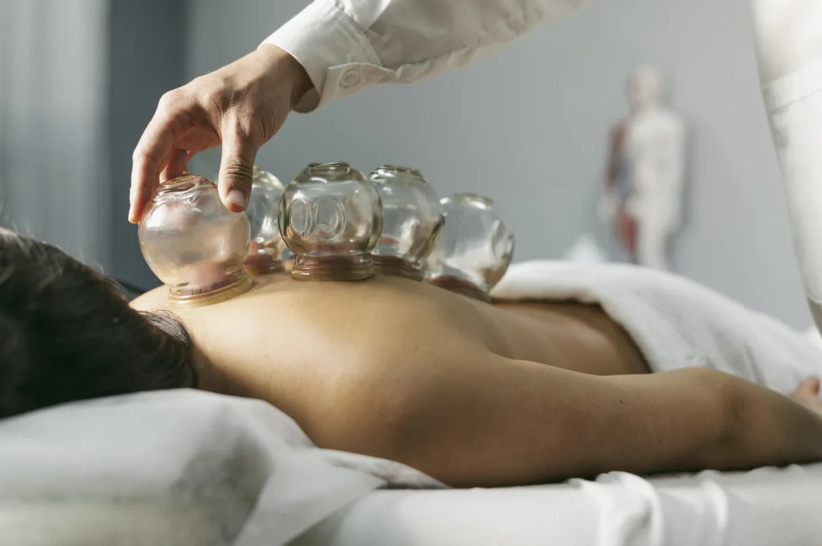 Therapist applying cupping therapy for shoulder pain relief in Bellevue spa