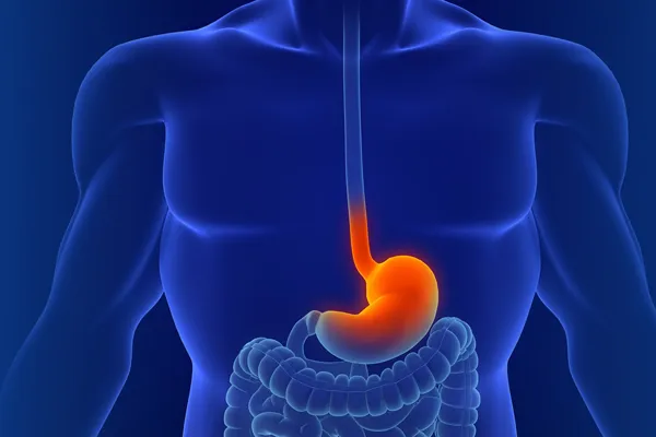 Gastric Sleeve Surgery